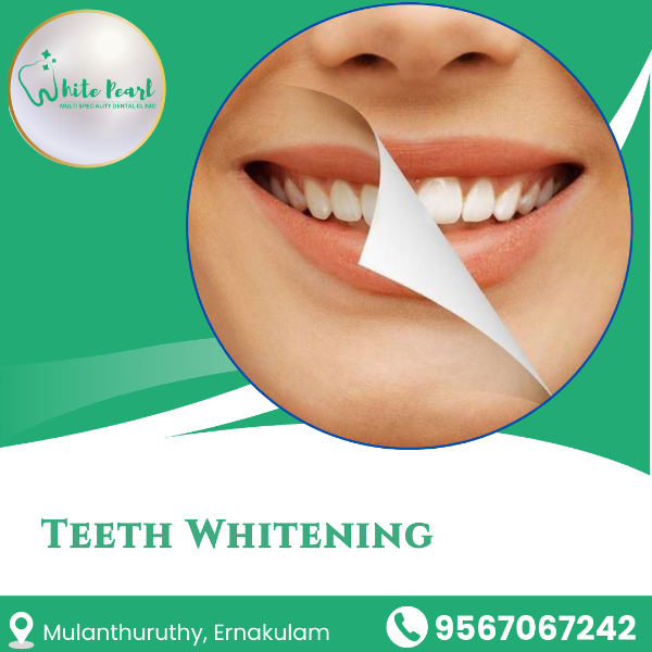 Teeth Whitening