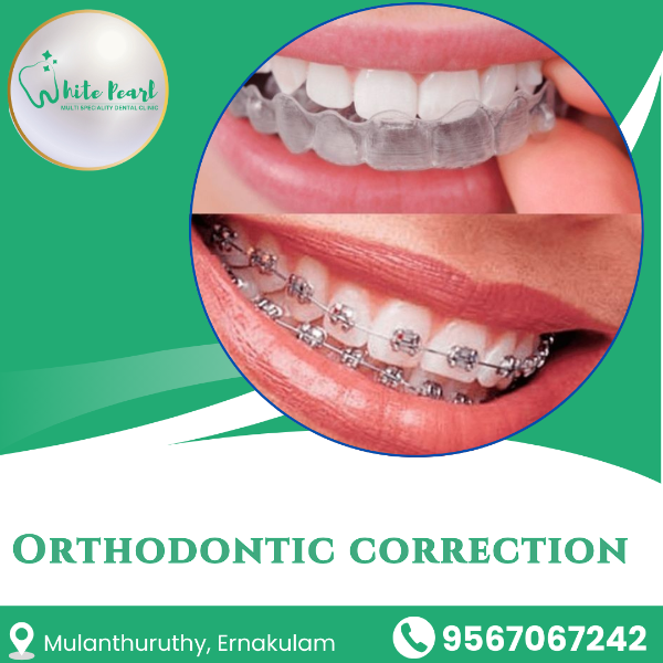 Orthodontic correction