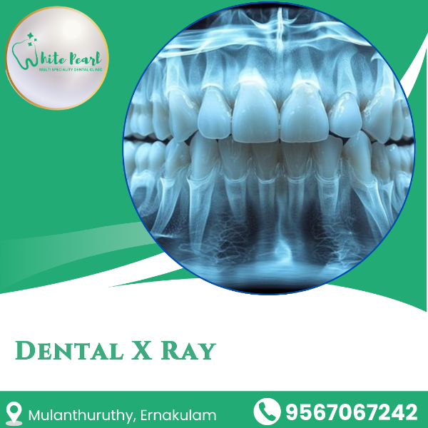 Dental X Ray