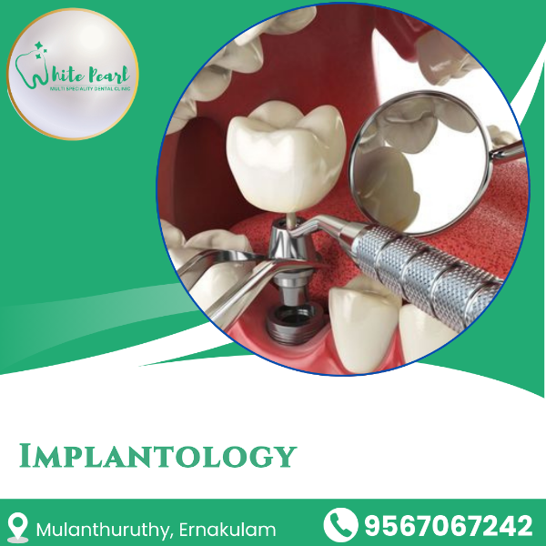 Implantology
