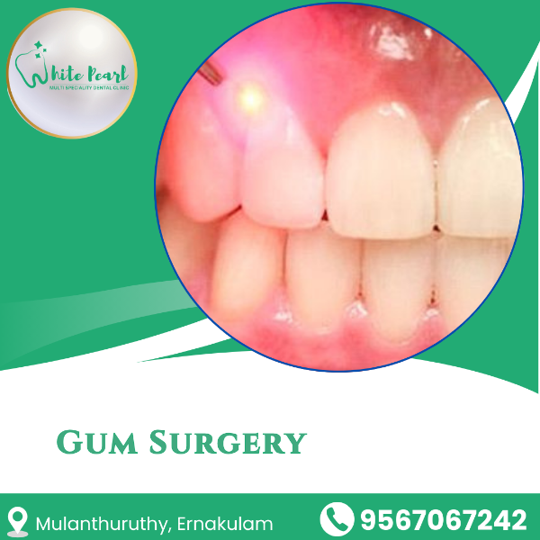 Gum Surgery