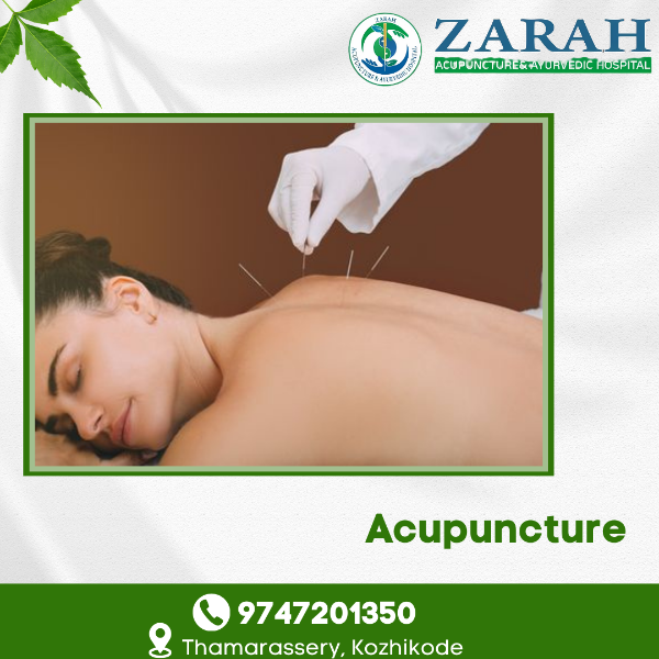 Acupuncture