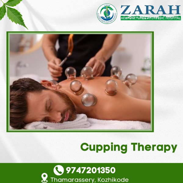 Cupping Therapy