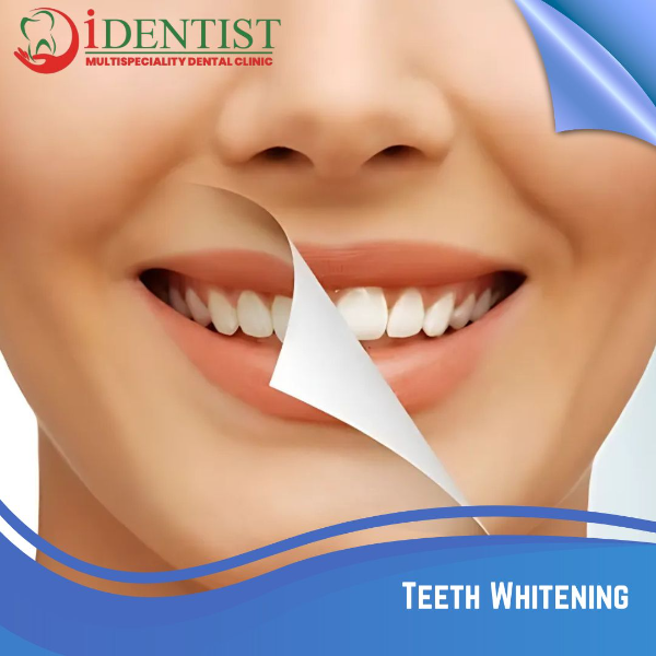 Teeth Whitening