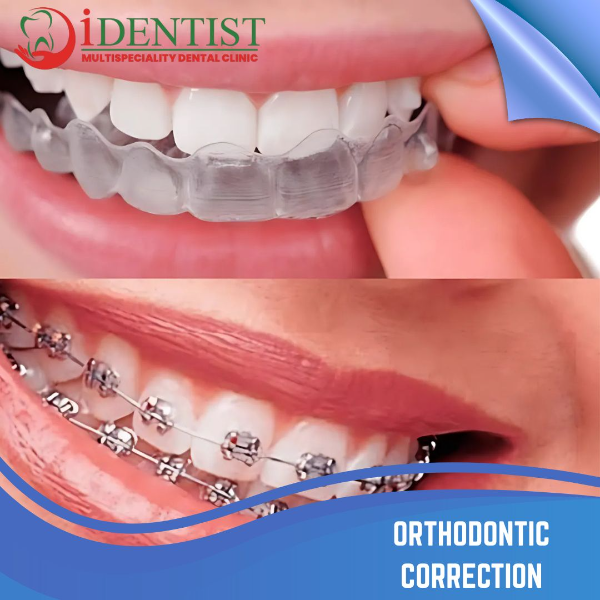 ORTHODONTIC CORRECTION