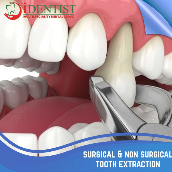 surgical & non surgical tooth extraction