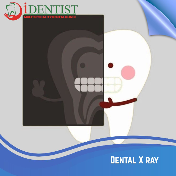 Dental X ray