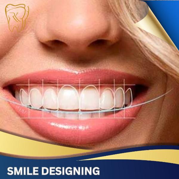 Smile Designing