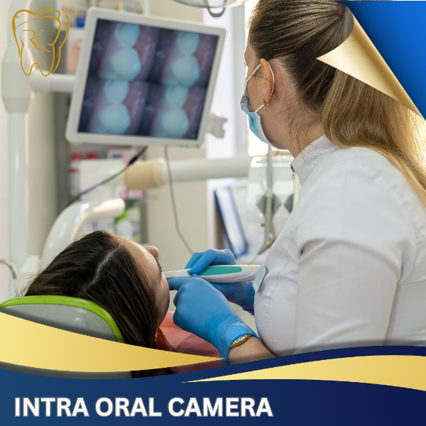 Intra Oral Camera