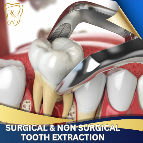 Surgical & Non Surgical Extraction