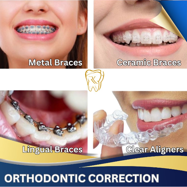 Orthodontic Correction