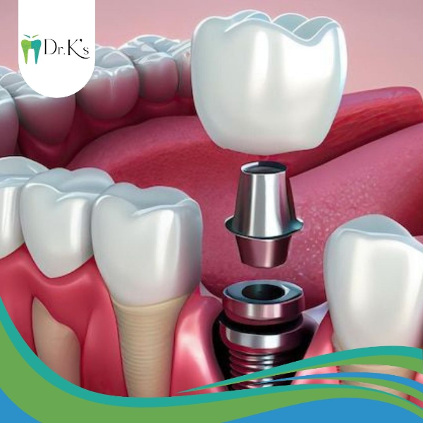 Implantology