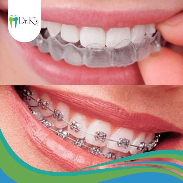 ORTHODONTIC CORRECTION
