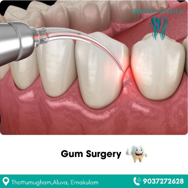 Gum Surgery