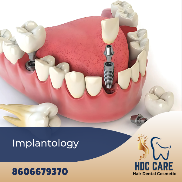 Implantology