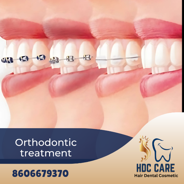 Orthodontic treatment