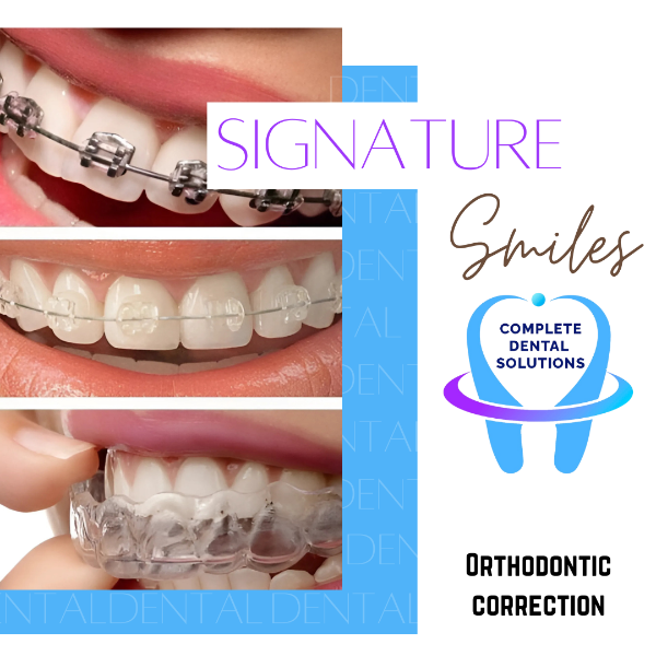Orthodontic Correction