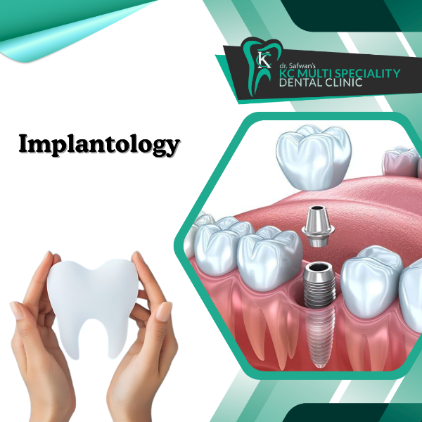 Implantology