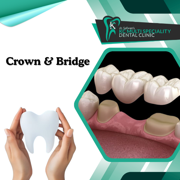 Crown & Bridge