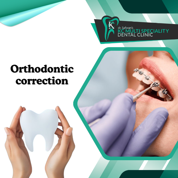 Orthodontic correction