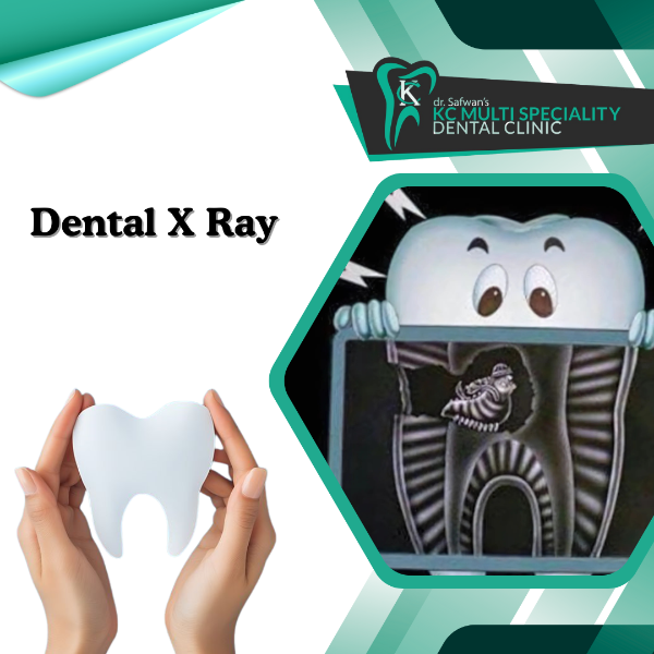 Dental X Ray