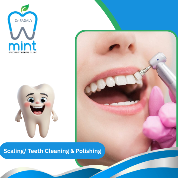Scaling/ Teeth Cleaning & Polishing