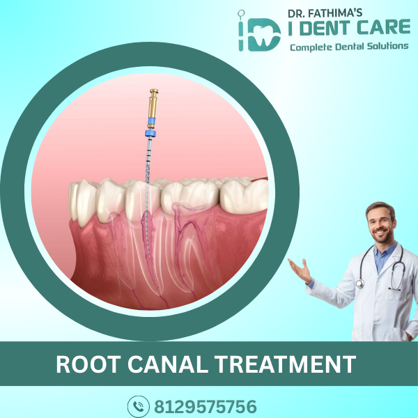 ROOT CANAL TREATMENT