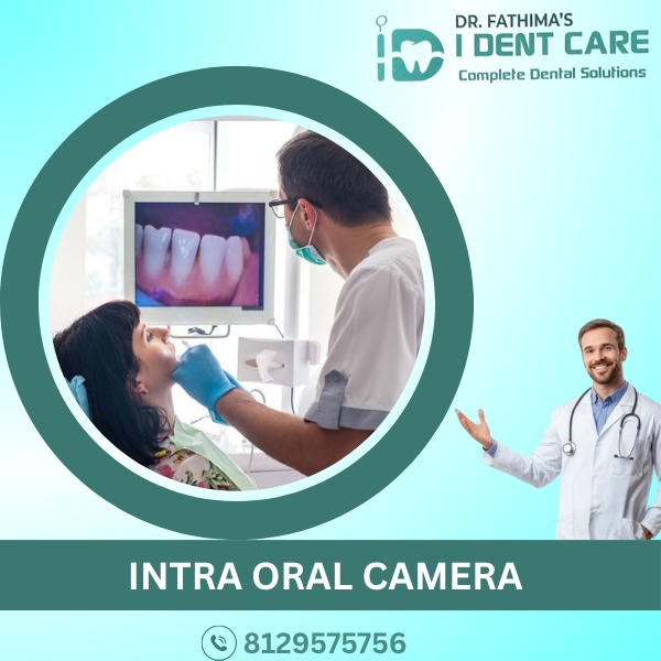 INTRA ORAL CAMERA