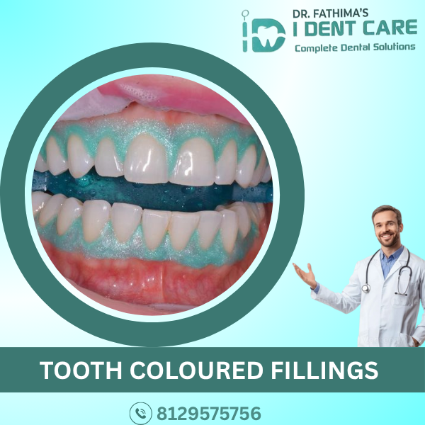 TOOTH COLOURED FILLINGS