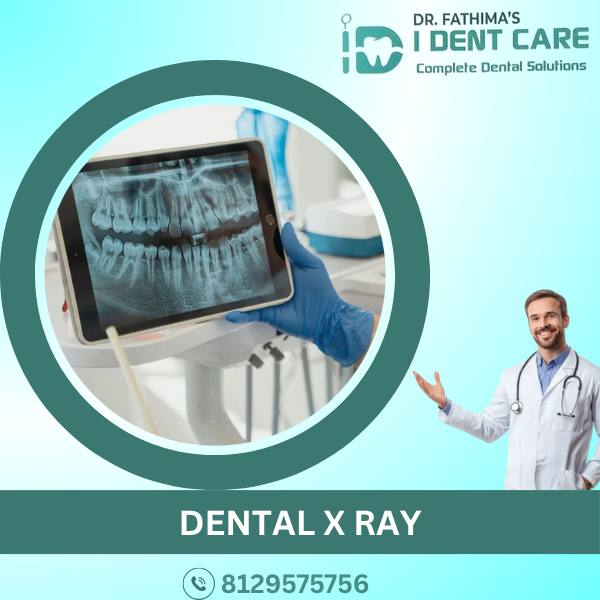 DENTAL X RAY