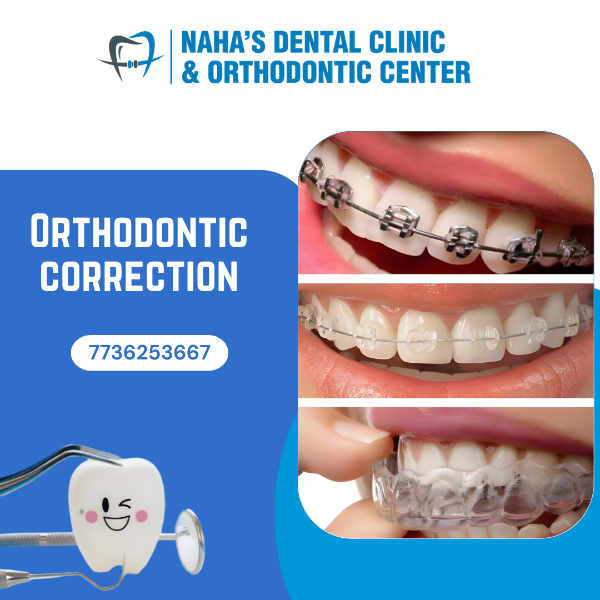 Orthodontic correction