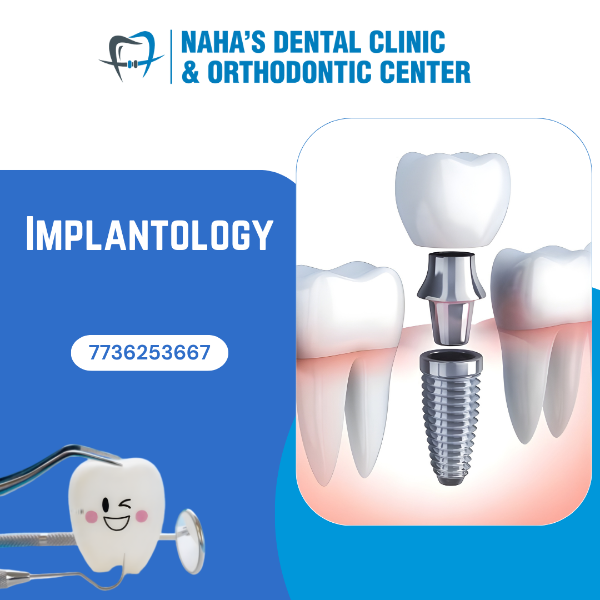 Implantology