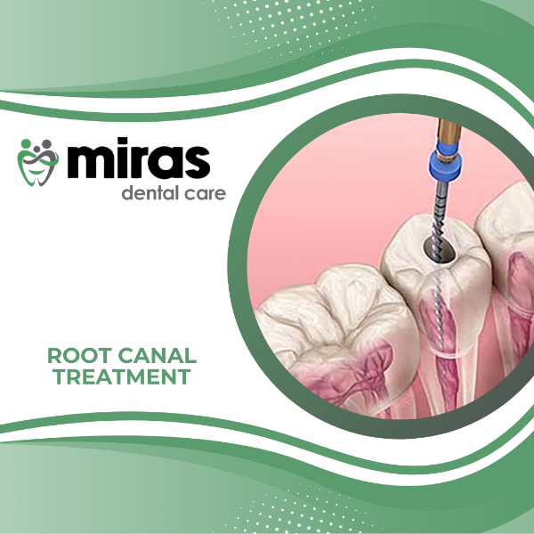 ROOT CANAL TREATMENT