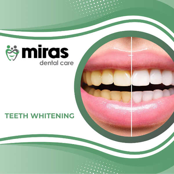 Teeth Whitening