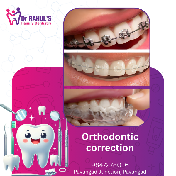 Orthodontic correction