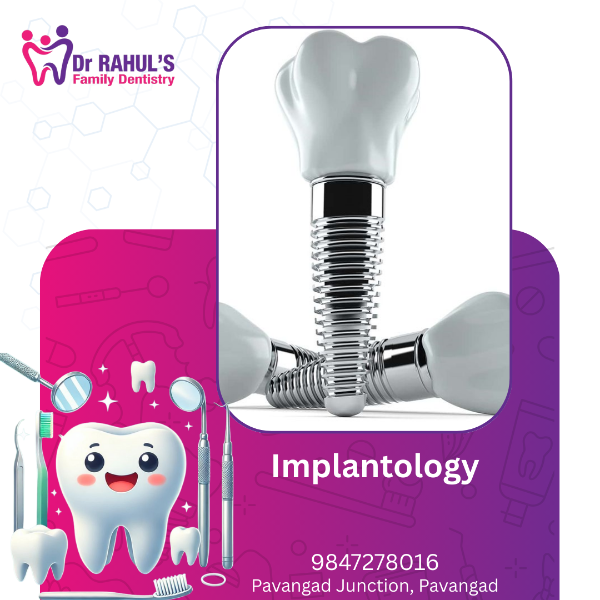 Implantology