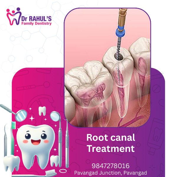 ROOT CANAL TREATMENT