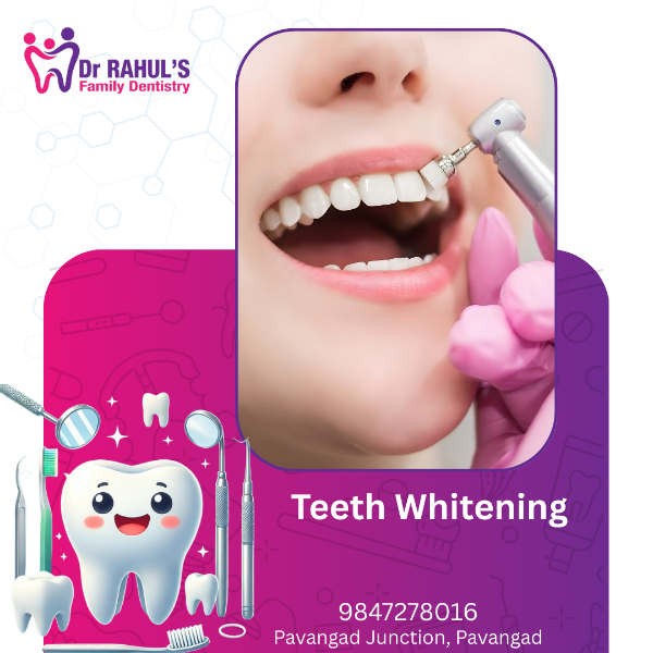 Teeth Whitening
