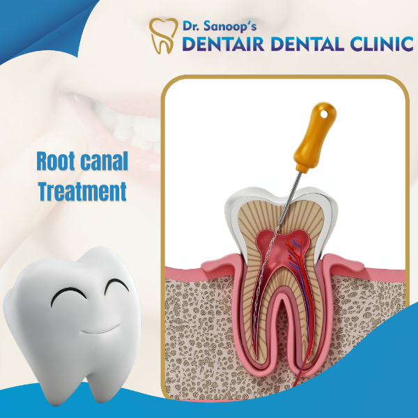 ROOT CANAL TREATMENT