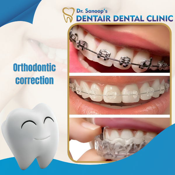 Orthodontic correction