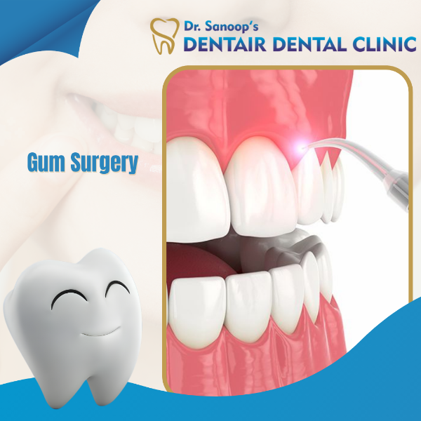Gum Surgery