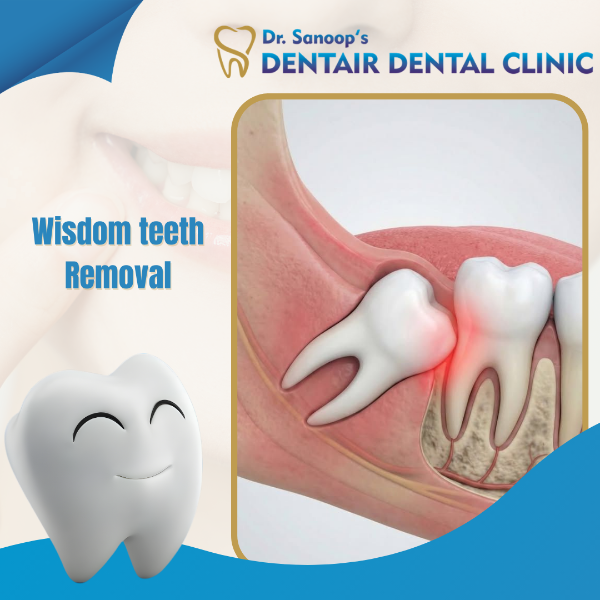 Wisdom teeth Removal