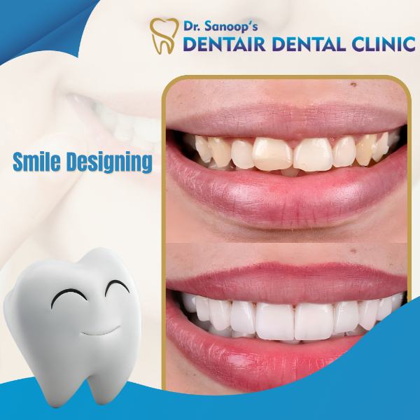 Smile Designing