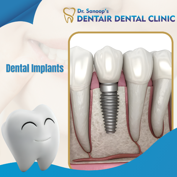 Dental implant