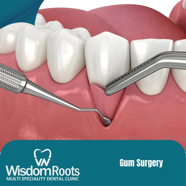 Gum Surgery