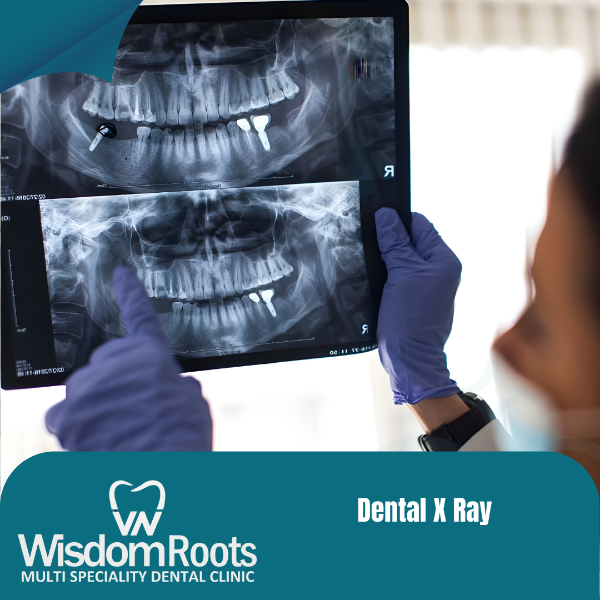 Dental X Ray