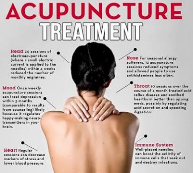 KOTTAKKAL ACUPUNCTURE, ACUPUNCTURE CENTER,  service in Kottakkal, Malappuram